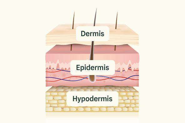 Illustration av de olika hudlagren ovanpå varandra. Överst: dermis. I mitten: epidermis. Underst: hypodermis.