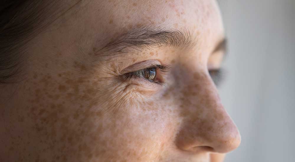 Close-up of freckled woman with smiling eyes