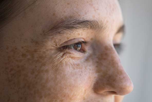 Close-up of freckled woman with smiling eyes